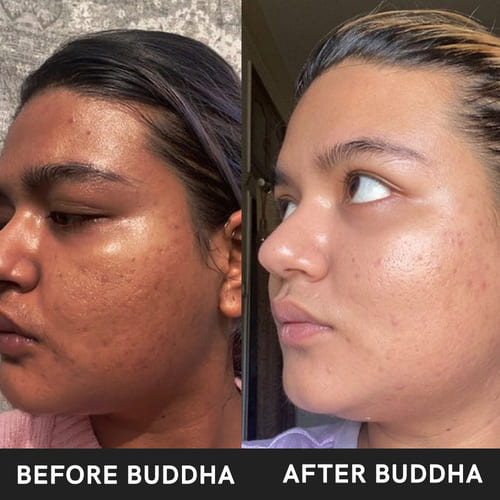 buddha natural anti tan kit before after image 