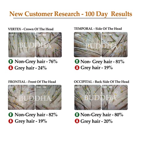 Anti Grey Hair Oil - 100% Ayush Certified - For Premature Greying, Restore Natural Hair Color (Both Men & Women)