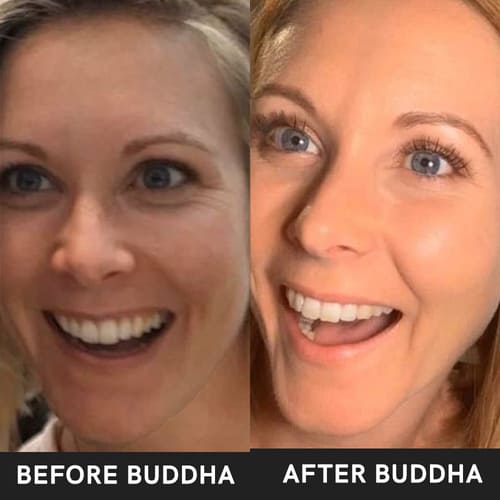 buddha natural 15 days body glow kit before after image 