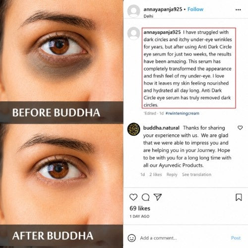 Anti Dark Circle Eye Serum Online Testimonial Review 