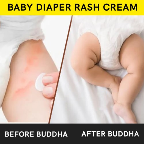 Buddha Natural Baby Diaper Rash Cream - before after use