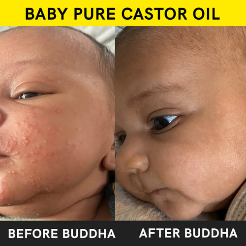 Buddha Natural baby pure castor oil before after image
