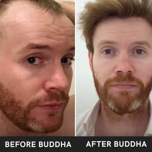 buddha natural bald hair and bald shampoo combo before after image 