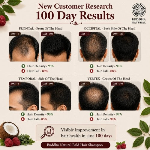 100 Days Results of Buddha Natural Bald Hair Shampoo 