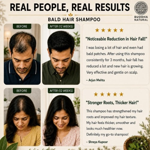 Real Customer Review of Buddha Natural Bald Hair Shampoo