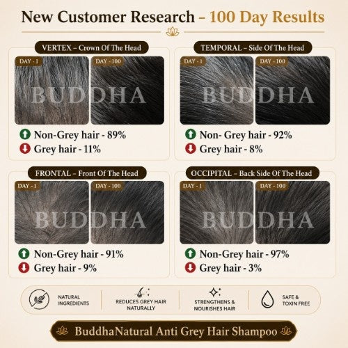 100 Days result of Buddha Natural Anti Grey Hair oil & Anti Grey Hair Shampoo Combo 