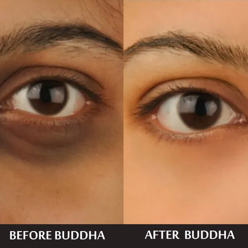 Buddha Natural Anti Dark Circle Eye Serum - before after use