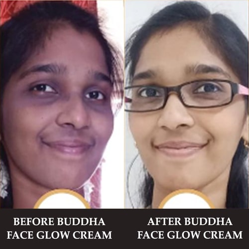customer reviews for best face cream for teenagers