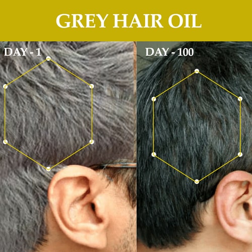 Anti Grey Hair Oil - 100% Ayush Certified - For Premature Greying, Restore Natural Hair Color (Both Men & Women)