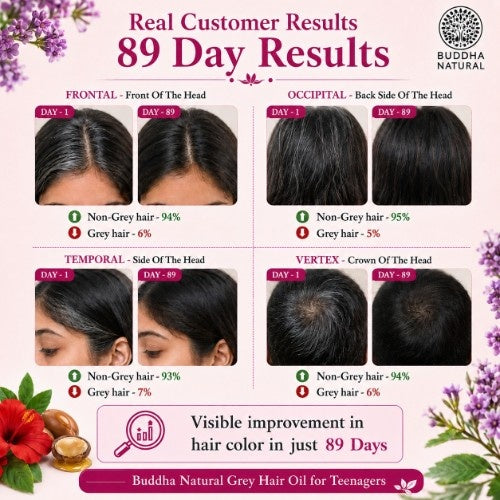 Visible Results of Buddha Natural Grey Hair Oil For Teenagers 
