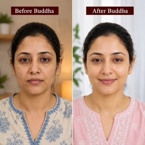 Before not Using Buddha Natural Kumkumadi Face Oil and After Using Buddha Natural Kumkumadi Face Oil Testimonial Results 