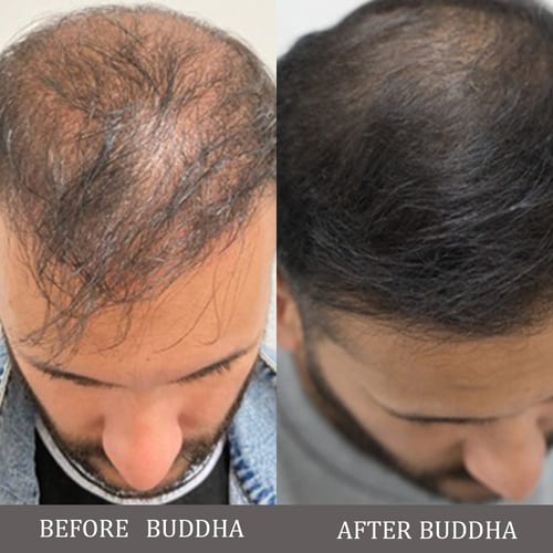 Buddha Natural - Before After