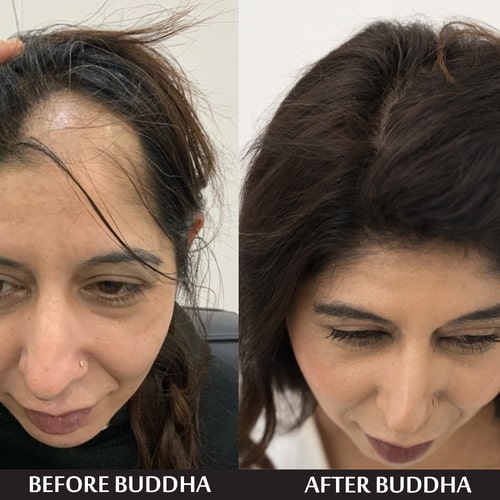 Buddha natural Anti Bald Hair Oil - customer reviews - herbal hair oil for baldnesshair - growth oil for bald head