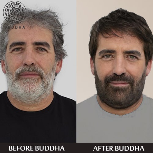 Buddha Natural Anti-Grey Hair Oil & Grey Beard Hair Serum Combo  - customer reviews - white beard to black beard oil - best oil for white beard and hair