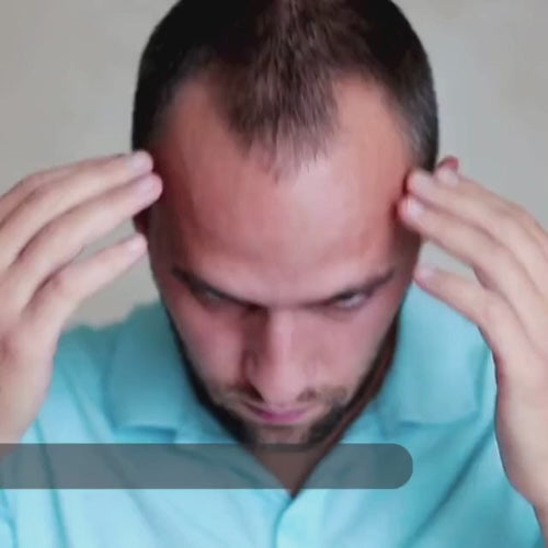 Video Of Buddha Natural Bald Hair Oil and Bald Shampoo Combo