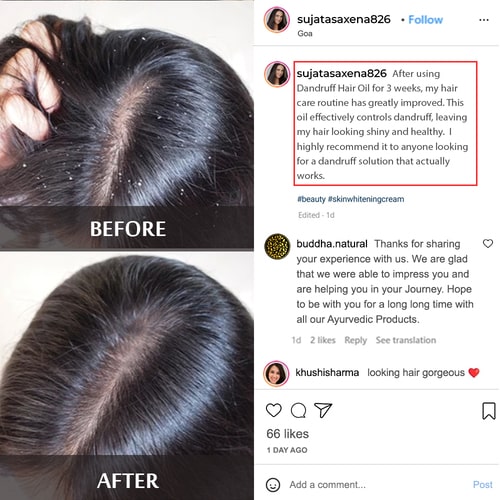 Buddha Natural Anti Dandruff Hair oil - customer reviews