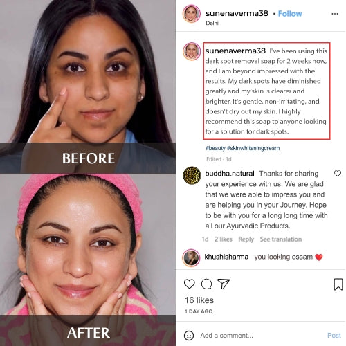 Buddha Natural Dark Spot Rremoval Soap used by sunena verma testimonal image customer review 